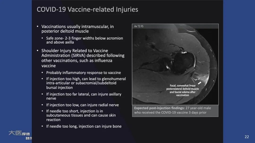 【PPT】COVID-19 的肌肉骨骼表现：对目前所描述的多模态成像及临床症状的图片综述​-20