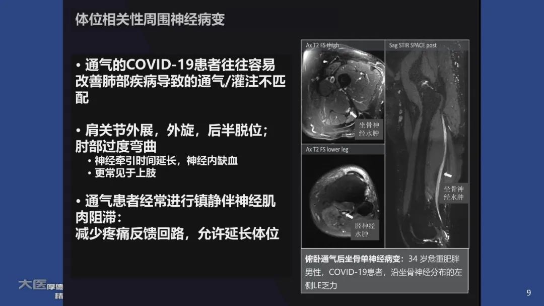 【PPT】COVID-19 的肌肉骨骼表现：对目前所描述的多模态成像及临床症状的图片综述​-7