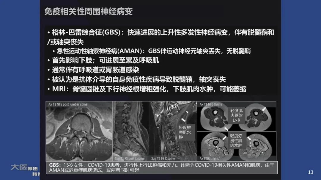 【PPT】COVID-19 的肌肉骨骼表现：对目前所描述的多模态成像及临床症状的图片综述​-11
