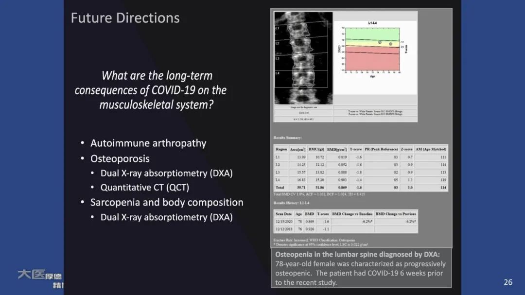 【PPT】COVID-19 的肌肉骨骼表现：对目前所描述的多模态成像及临床症状的图片综述​-24