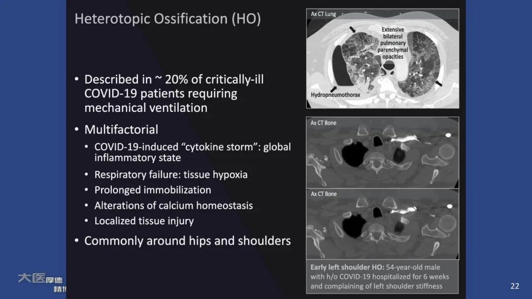 【PPT】COVID-19 的肌肉骨骼表现：对目前所描述的多模态成像及临床症状的图片综述​-22