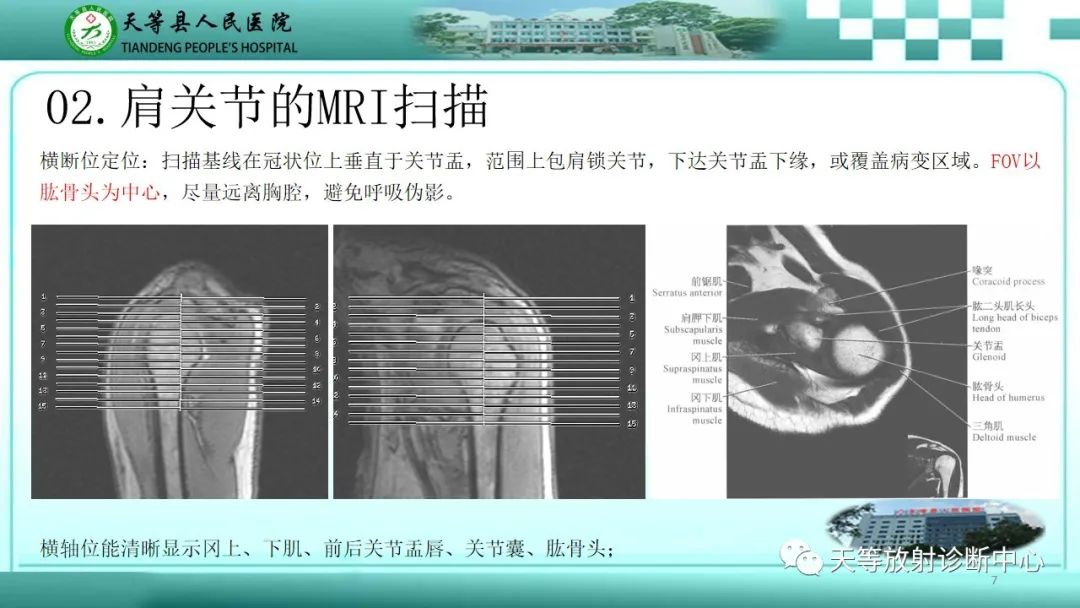 【PPT】肩关节MRI扫描技术-7