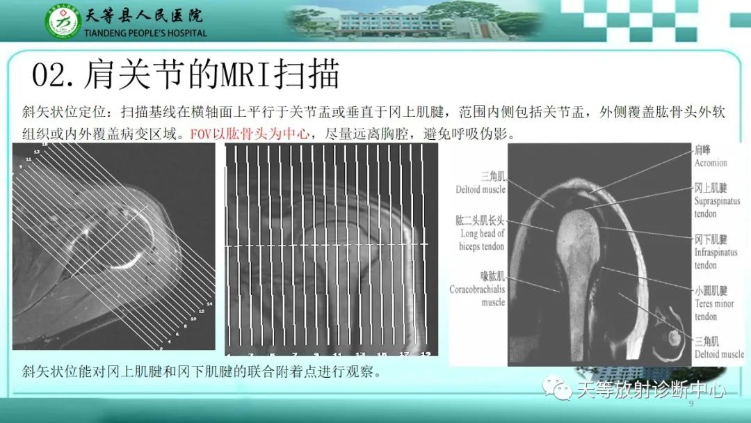 【PPT】肩关节MRI扫描技术-9
