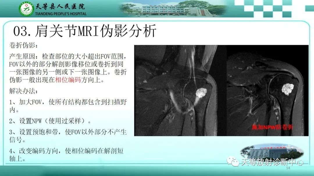 【PPT】肩关节MRI扫描技术-14