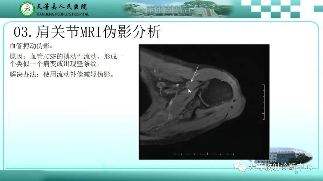 【PPT】肩关节MRI扫描技术-15