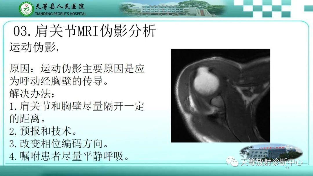 【PPT】肩关节MRI扫描技术-13