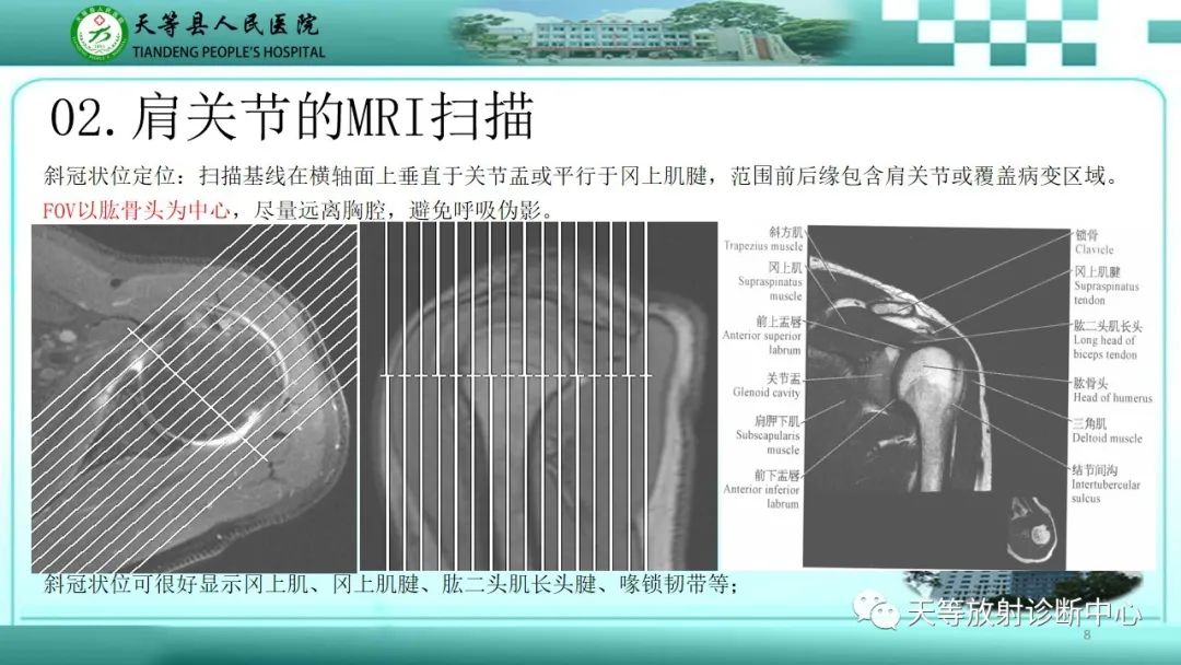 【PPT】肩关节MRI扫描技术-8