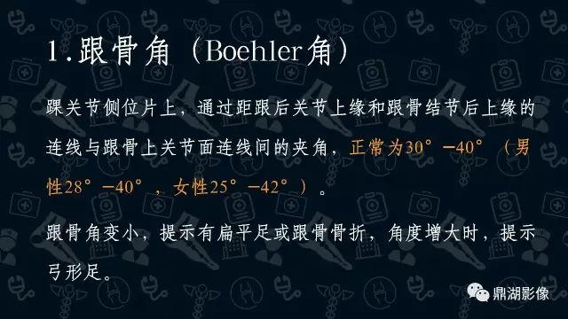 扁平足X线测量方法