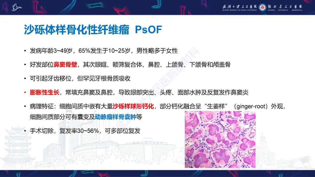 【PPT】颌面部骨化性纤维瘤影像诊断-19