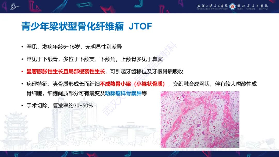 【PPT】颌面部骨化性纤维瘤影像诊断-16