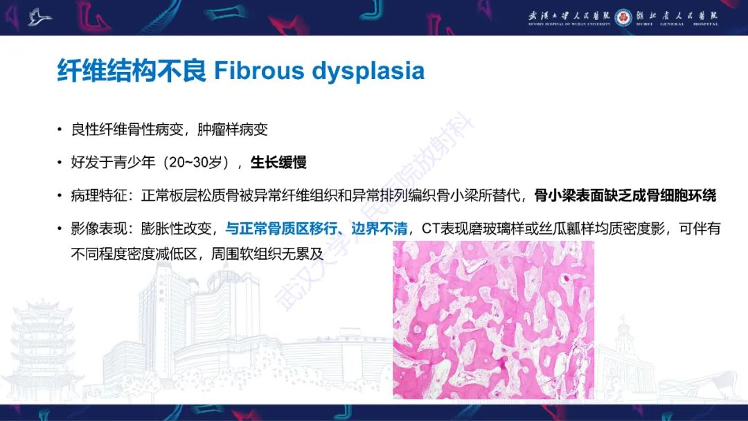 【PPT】颌面部骨化性纤维瘤影像诊断-26