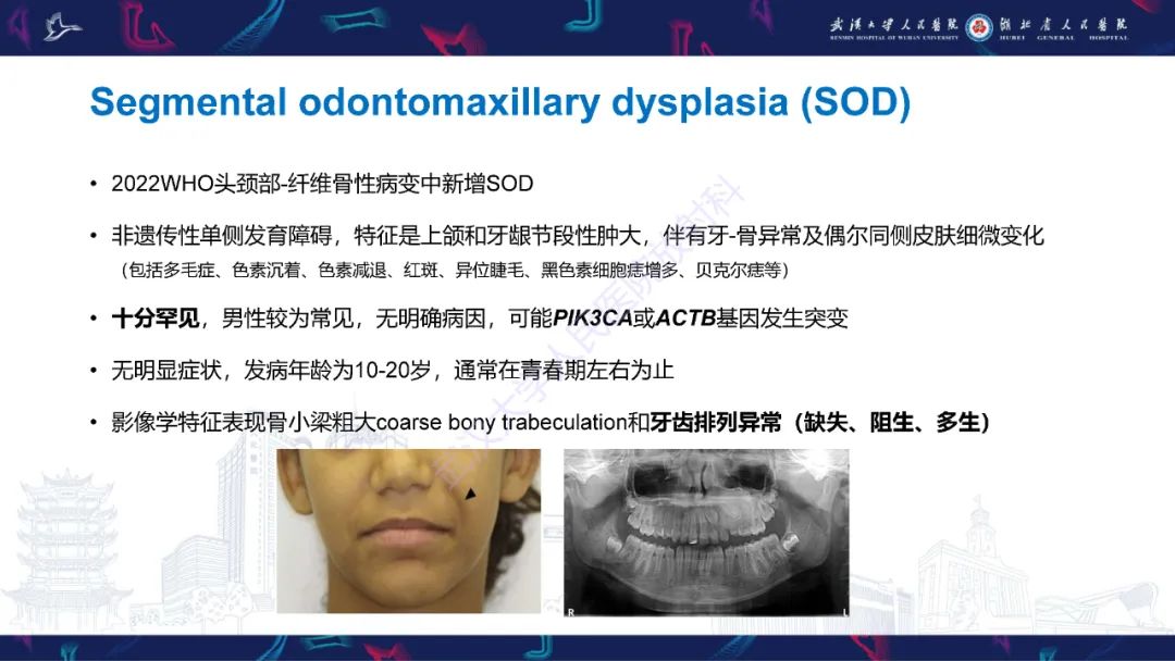 【PPT】颌面部骨化性纤维瘤影像诊断-32