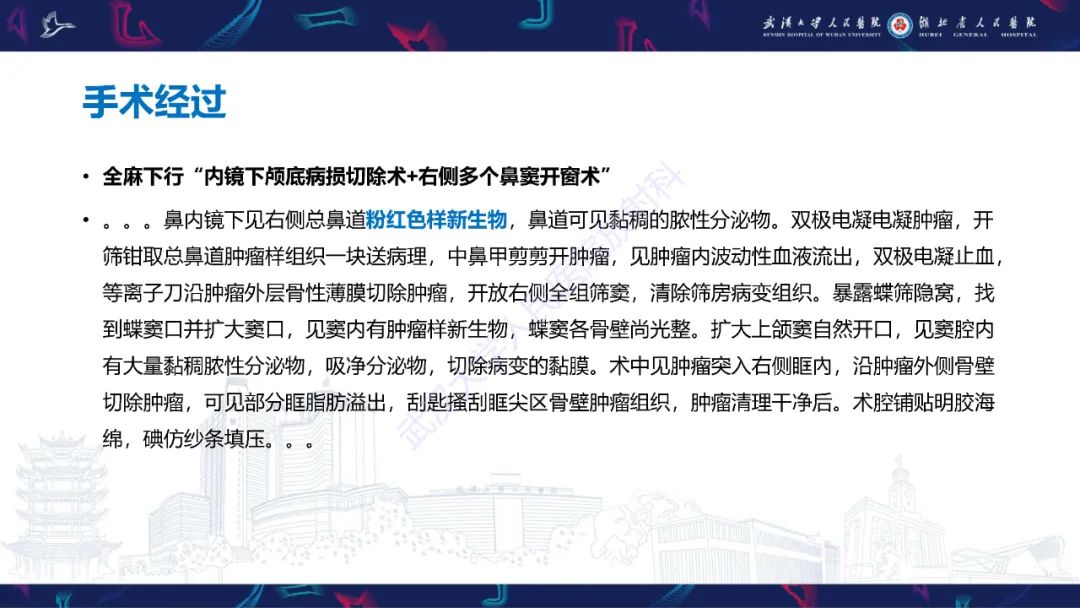 【PPT】颌面部骨化性纤维瘤影像诊断-5