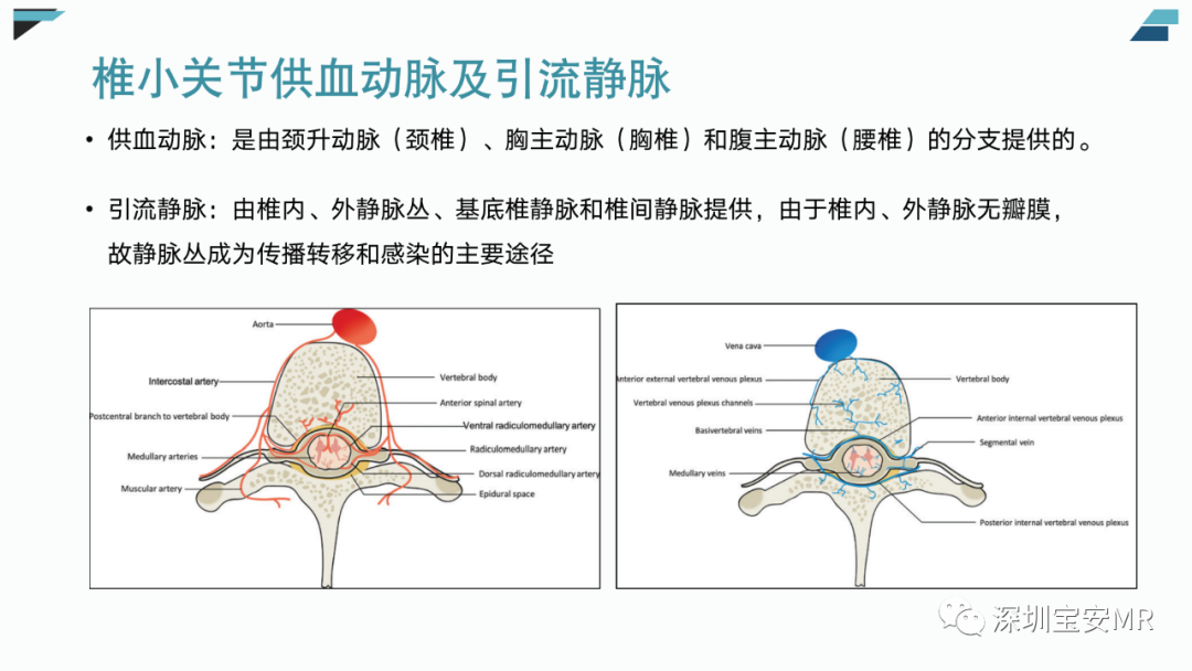 【PPT】椎小关节常见病变的影像表现-5