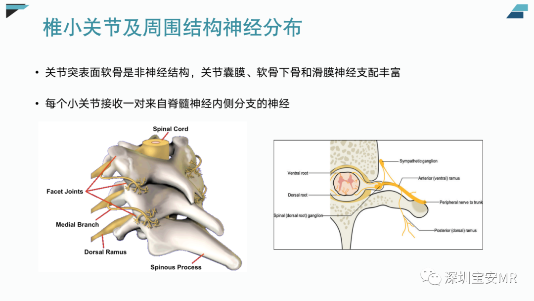 【PPT】椎小关节常见病变的影像表现-6