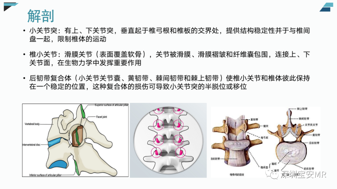 【PPT】椎小关节常见病变的影像表现-4