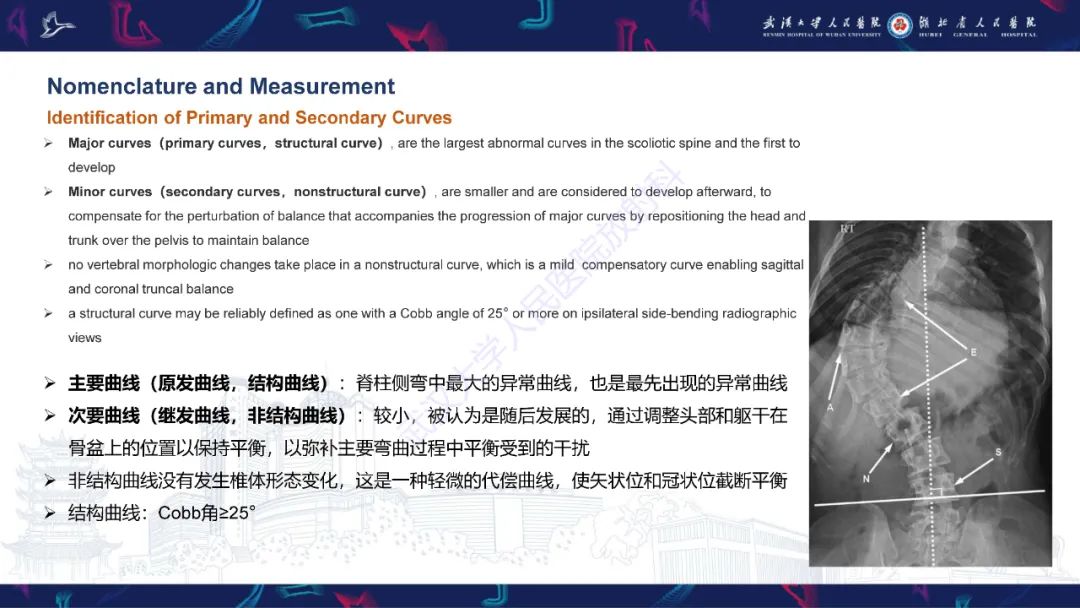 【PPT】脊柱侧弯影像学评估-14
