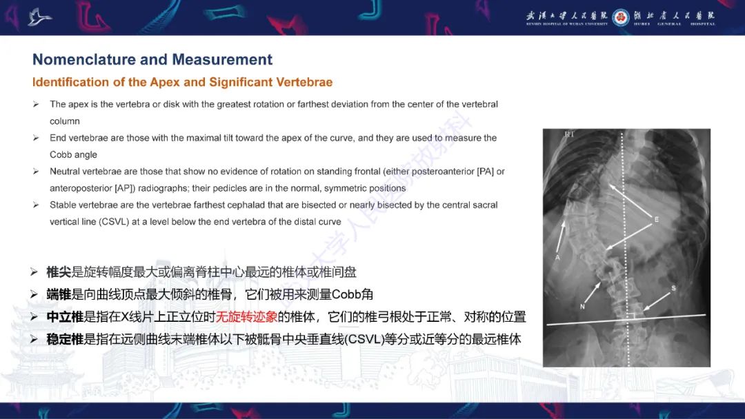 【PPT】脊柱侧弯影像学评估-9