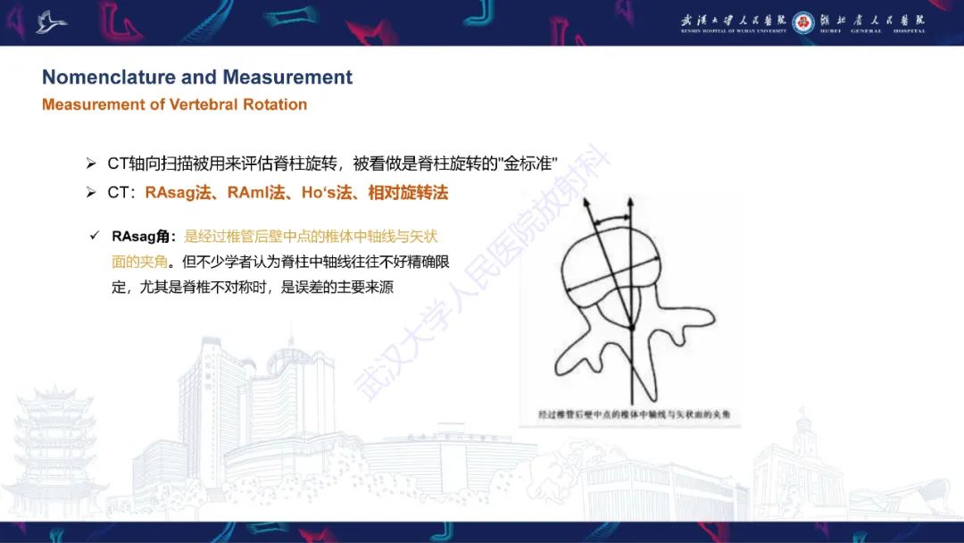 【PPT】脊柱侧弯影像学评估-21