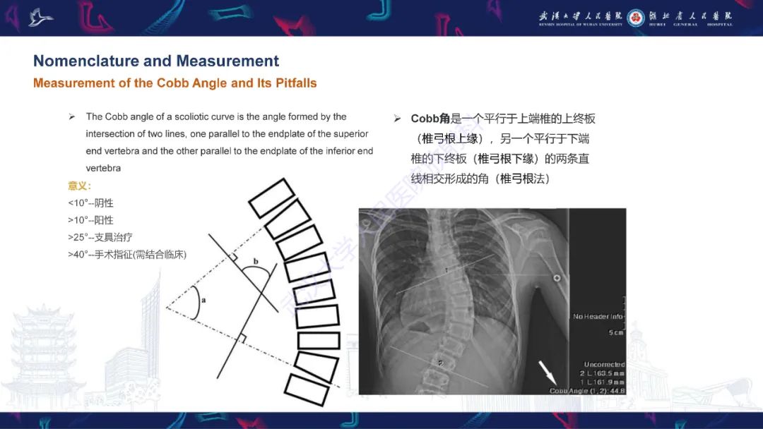 【PPT】脊柱侧弯影像学评估-11
