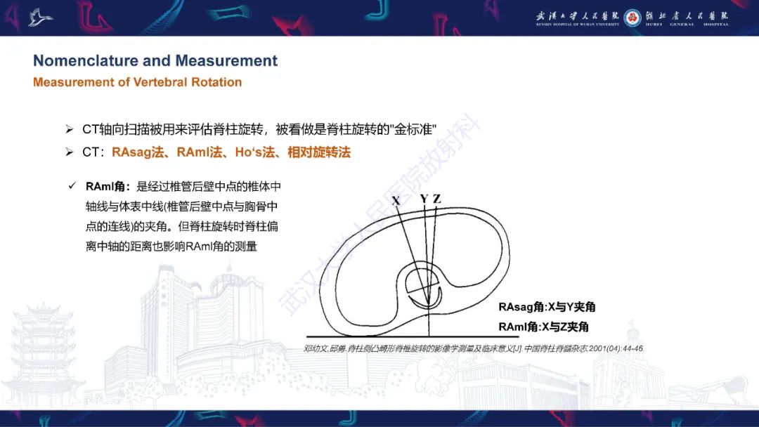 【PPT】脊柱侧弯影像学评估-22