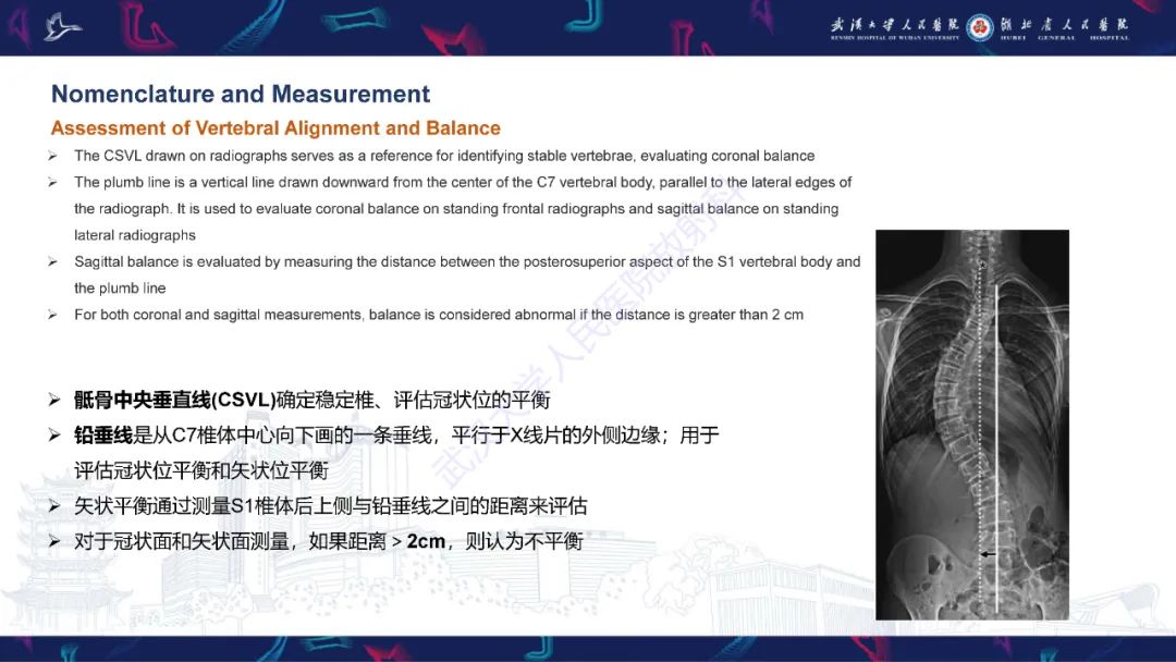 【PPT】脊柱侧弯影像学评估-16