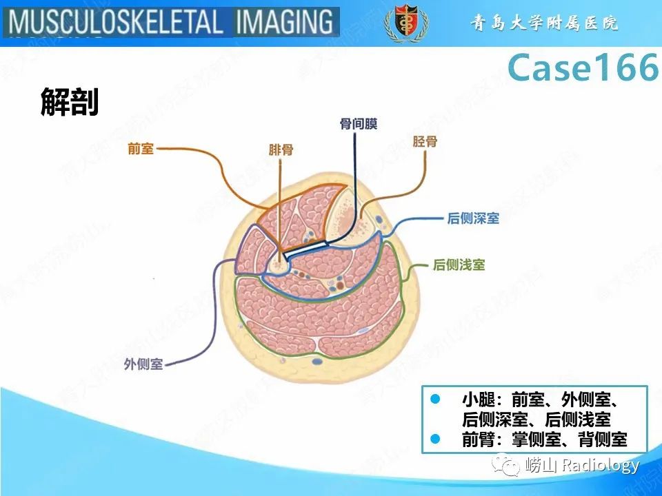 【PPT】骨筋膜室综合征-15