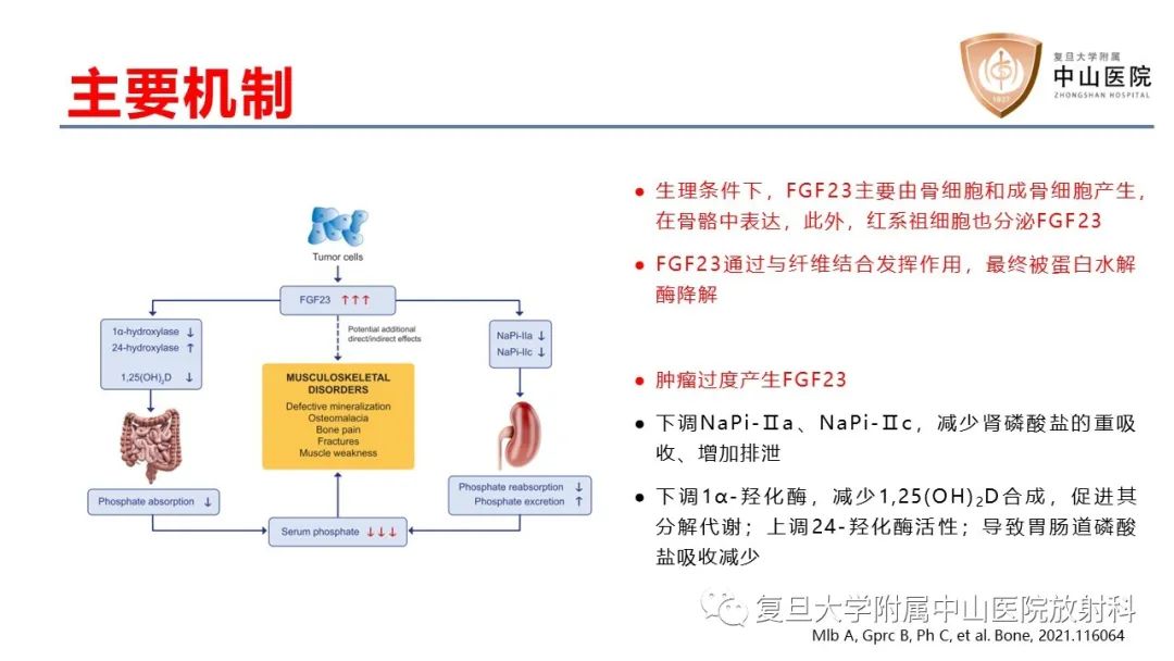 【病例】肿瘤相关性骨软化症1例X线CT及MR/PET-CT-15