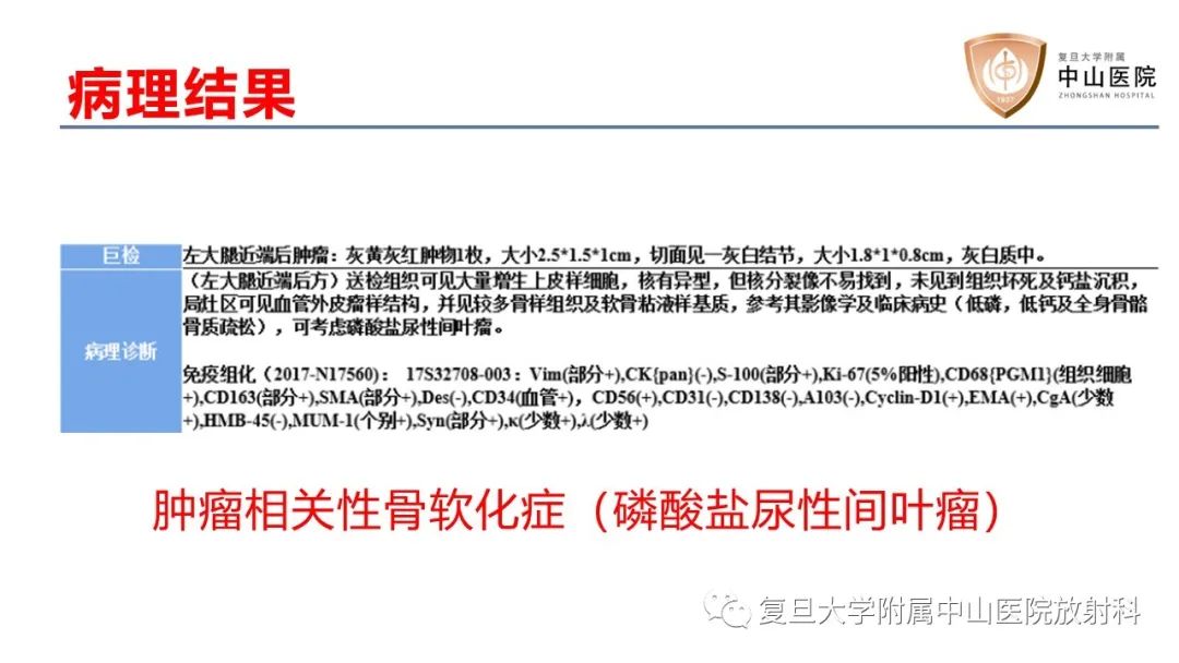 【病例】肿瘤相关性骨软化症1例X线CT及MR/PET-CT-12