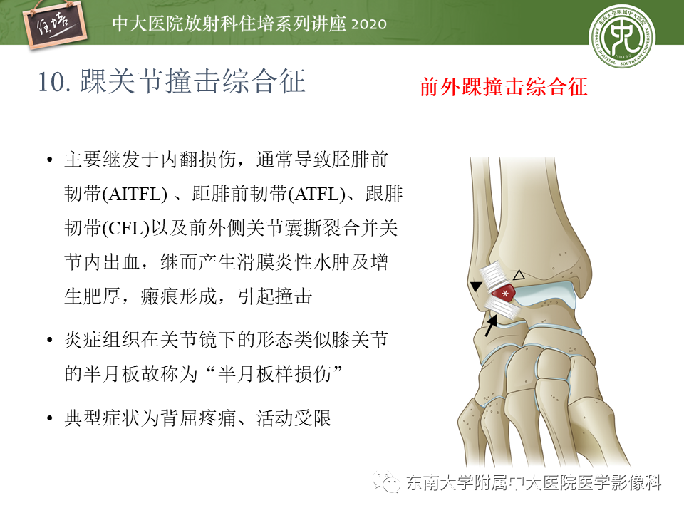 【PPT】常见撞击综合征的影像诊断-51