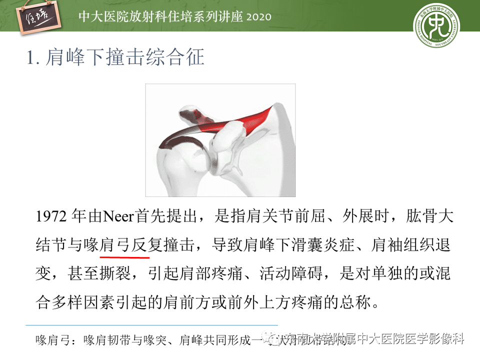 【PPT】常见撞击综合征的影像诊断-3