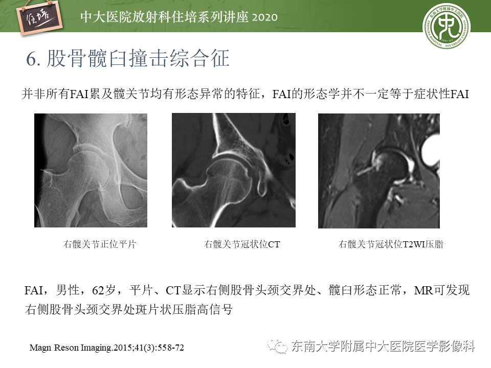【PPT】常见撞击综合征的影像诊断-43