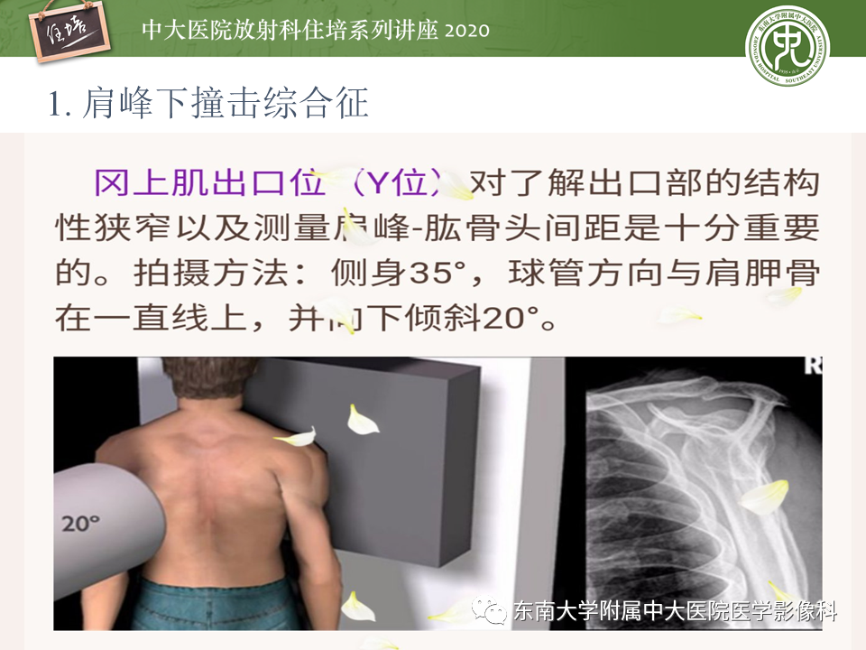 【PPT】常见撞击综合征的影像诊断-5