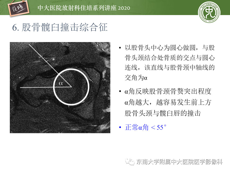 【PPT】常见撞击综合征的影像诊断-33