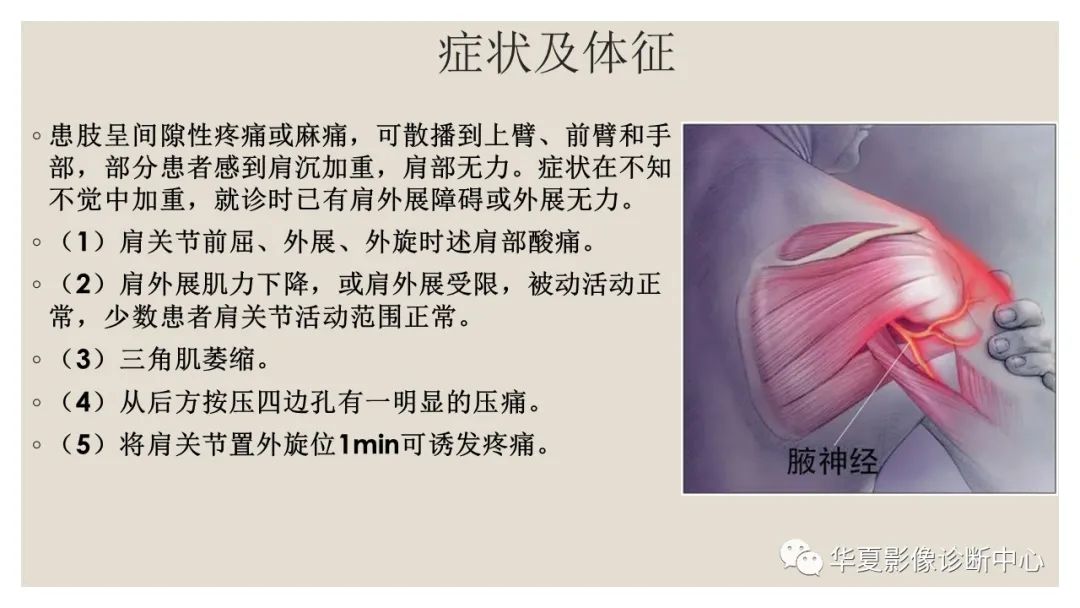 【PPT】四边孔综合征-6