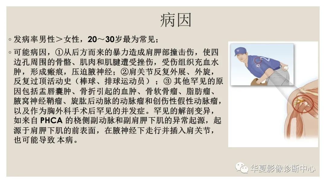 【PPT】四边孔综合征-5