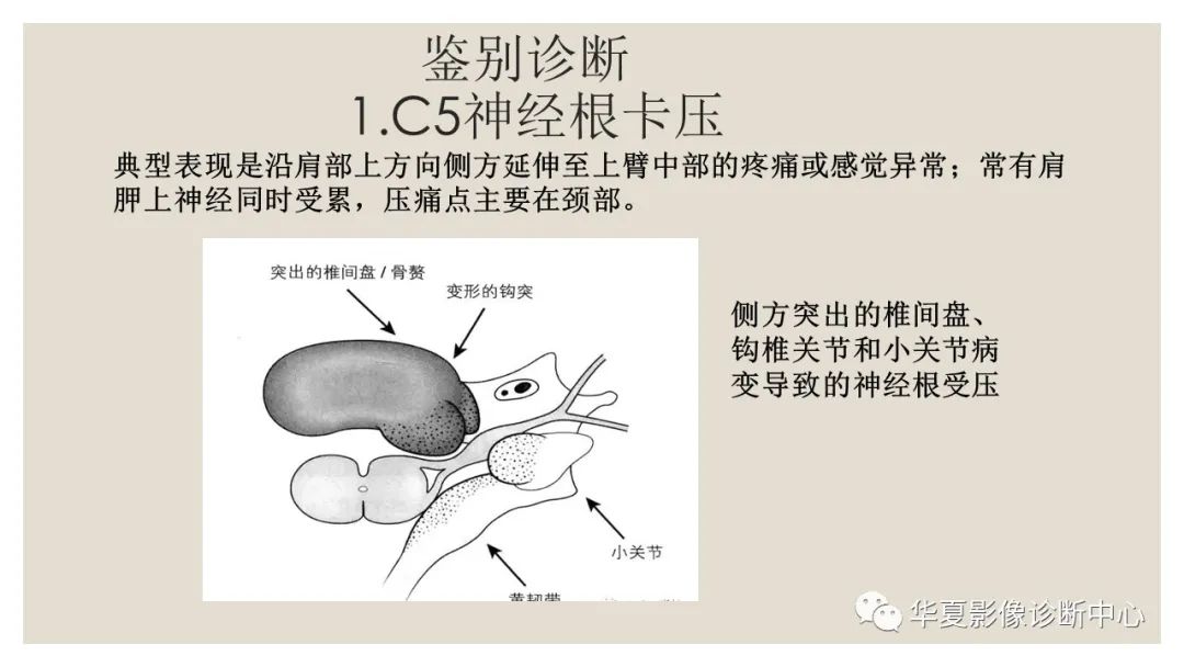 【PPT】四边孔综合征-10