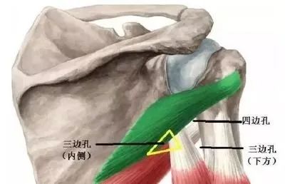 四边孔综合征-6