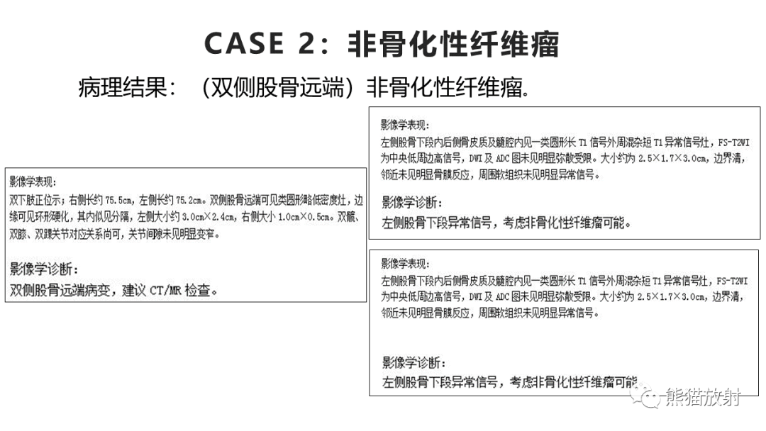 【病例】长骨非骨化性纤维瘤2例X线CT及MR-24