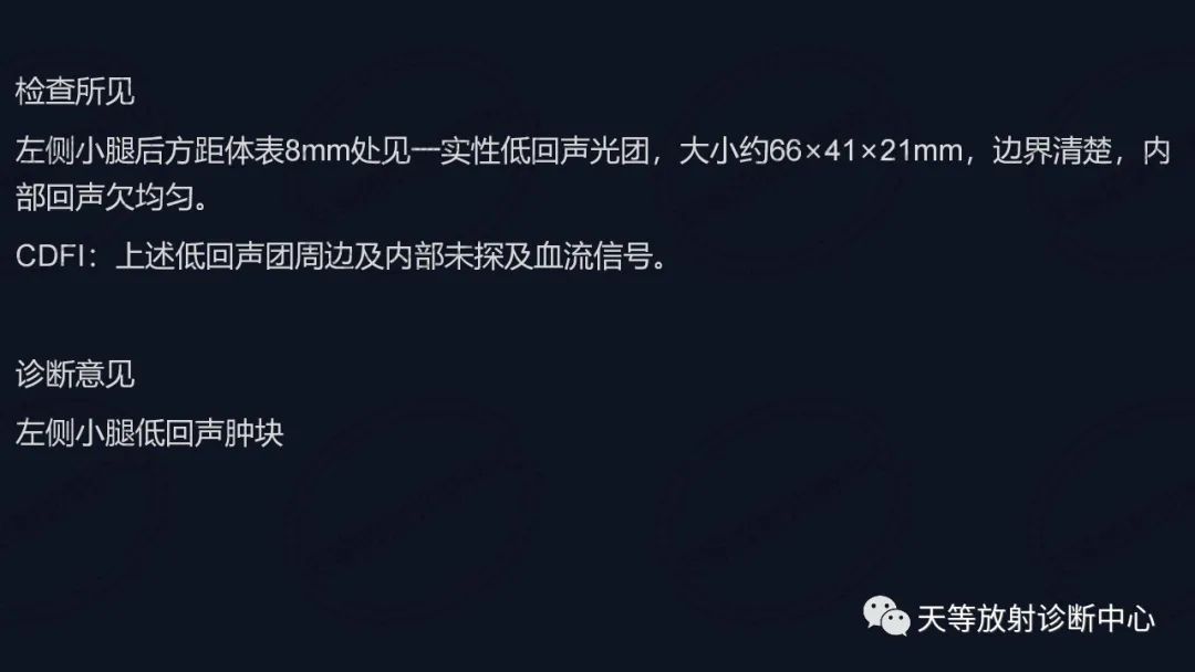 【病例】软组织血管瘤1例MR-6