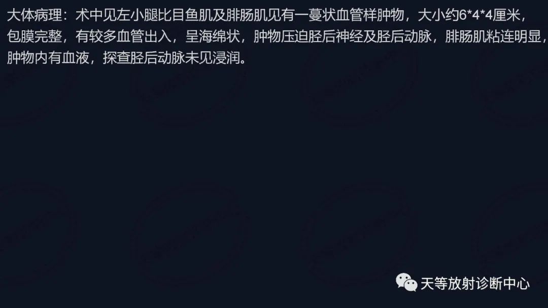 【病例】软组织血管瘤1例MR-15