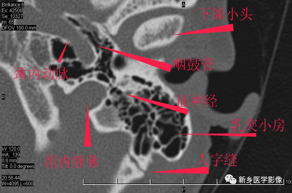 耳部详细解剖纯手工标注