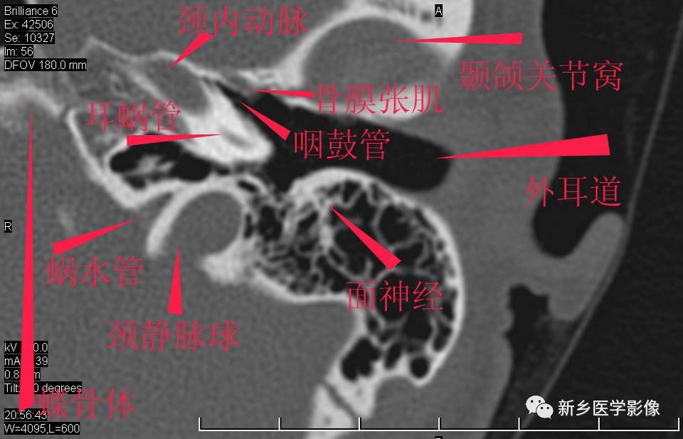 耳部详细解剖纯手工标注