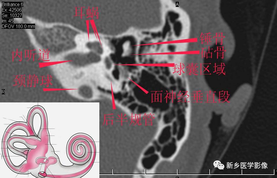 耳部详细解剖纯手工标注