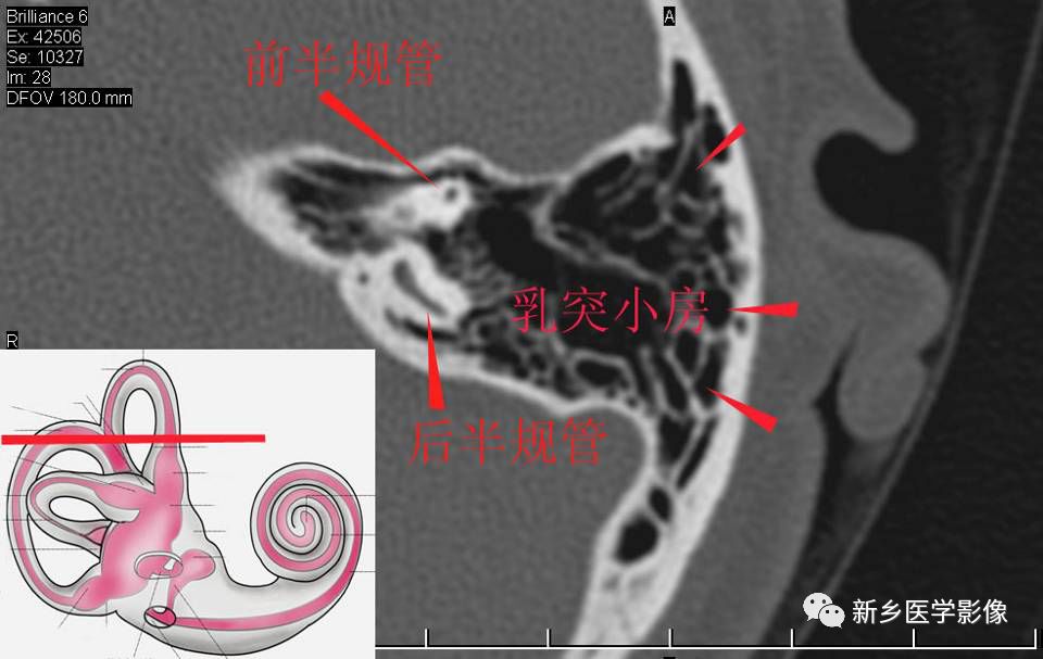 耳部详细解剖纯手工标注