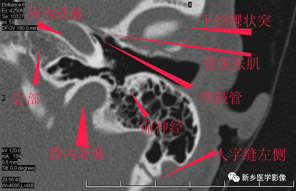 耳部详细解剖纯手工标注