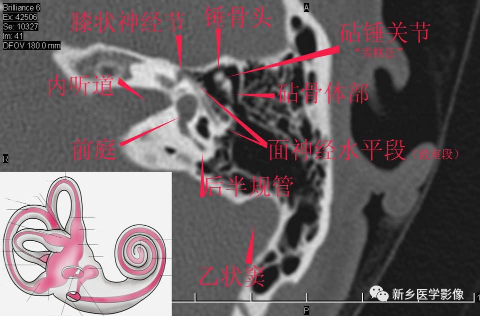 耳部详细解剖纯手工标注