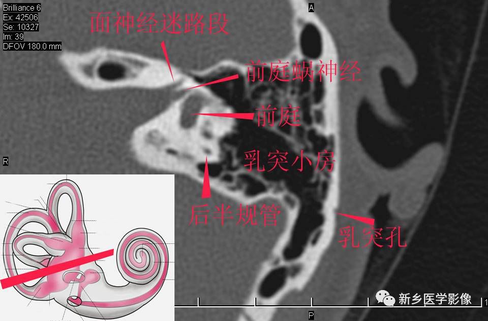 耳部详细解剖纯手工标注