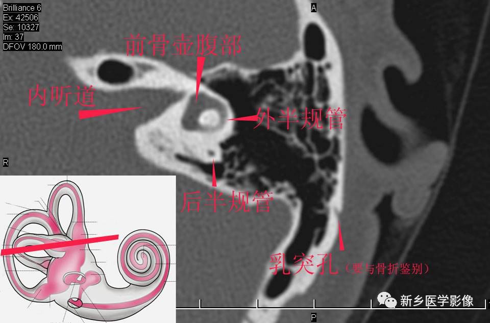 耳部详细解剖纯手工标注