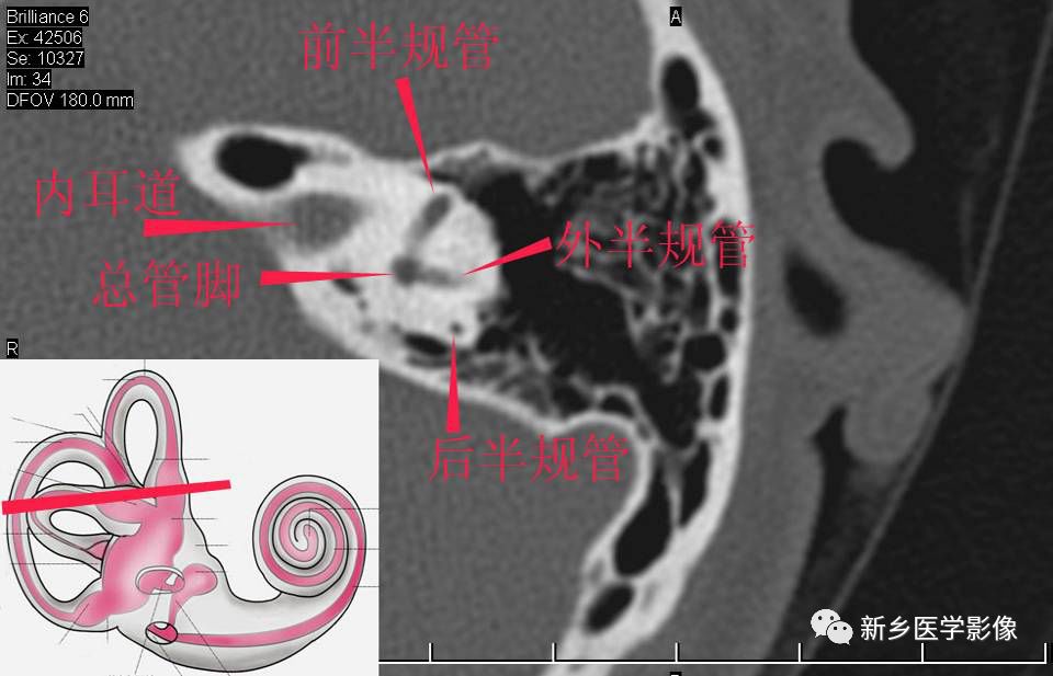 耳部详细解剖纯手工标注